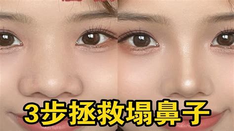 鼻頭大原因|【鼻頭大原因】鼻頭圓大、肥鼻翼怎麼救？日常「3壞習慣」讓鼻。